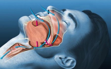 استخدام الذكاء الاصطناعي للكشف السريع والدقيق عن انقطاع التنفس الانسدادي أثناء النوم