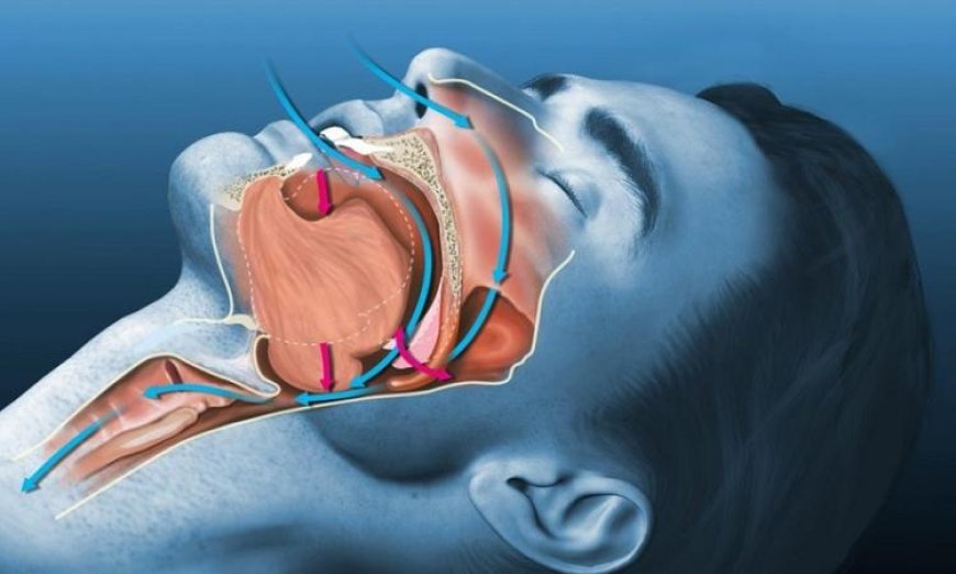 استخدام الذكاء الاصطناعي للكشف السريع والدقيق عن انقطاع التنفس الانسدادي أثناء النوم