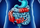 اكتشاف جديد يحقق الأمل لمرضى تليف الأمعاء وينهي معاناتهم