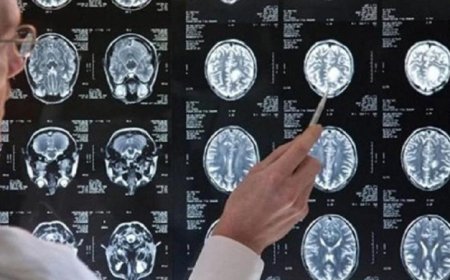 علماء يبتكرون تقنية جديدة لجعل الدماغ شفافا لرصد نشاطه بتفاصيل دقيقة