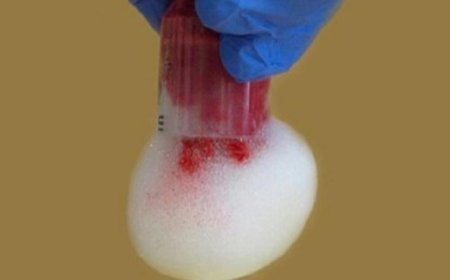 ابتكار رغوة ذكية لإيقاف النزيف الداخلي وإنقاذ الأرواح من خطر الموت