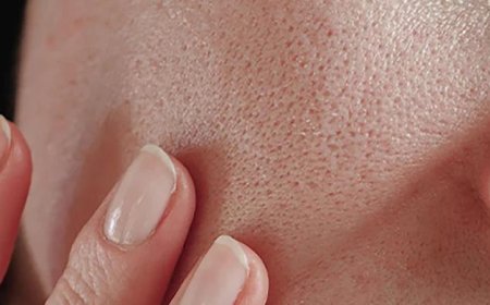 أفضل وصفات طبيعية للتخلص من المسام الواسعة بشكل فعال