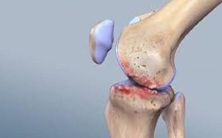 اكتشف أفضل تمارين تخفيف آلام التهاب مفاصل الركبة حسب الدراسات العلمية