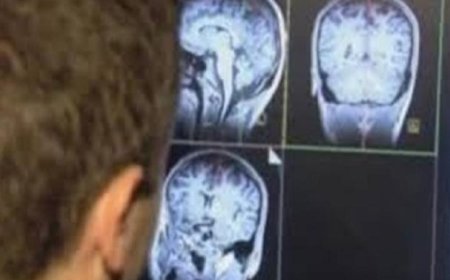 الرياضة تعالج آثار الصدمات النفسية في الدماغ الناتجة عن تجارب الطفولة