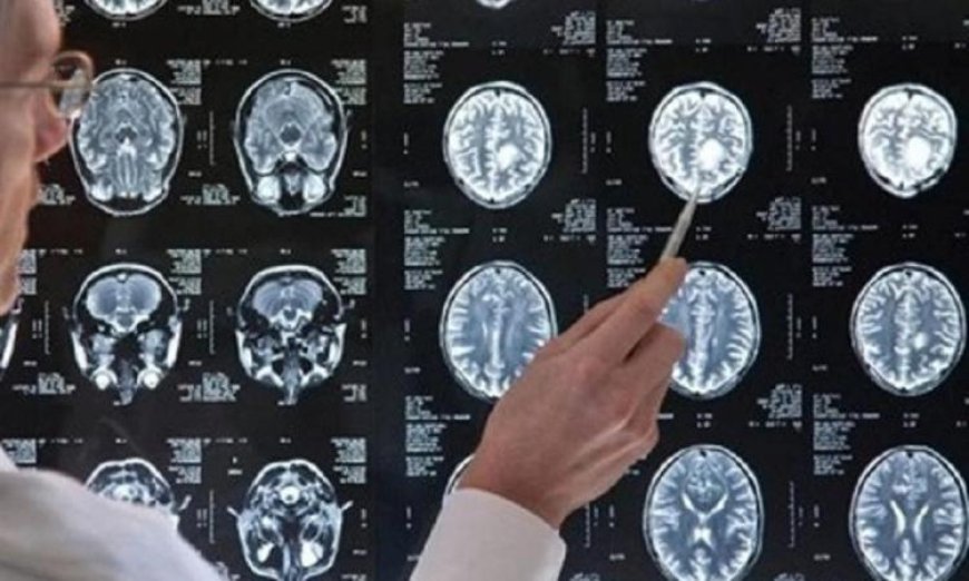 علماء يبتكرون تقنية جديدة لجعل الدماغ شفافا لرصد نشاطه بتفاصيل دقيقة