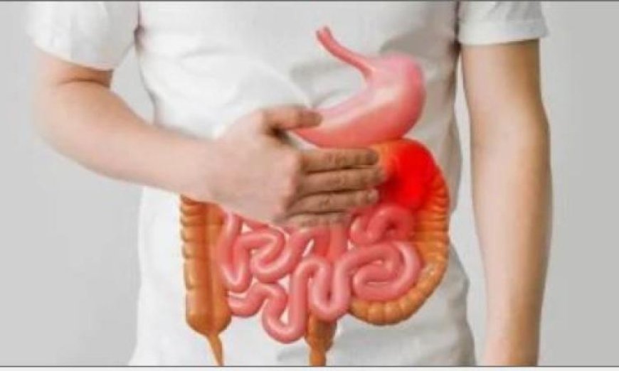 دراسة جديدة تكشف العلاقة بين الجهاز الهضمي وبداية التصلب المتعدد