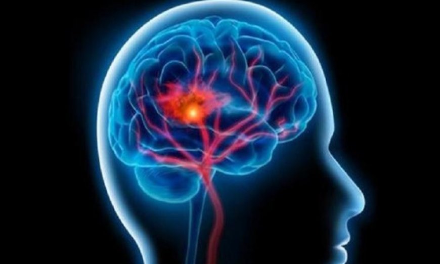 اكتشاف تقنيات جديدة لإزالة جلطات الدماغ بفضل الذكاء الاصطناعي