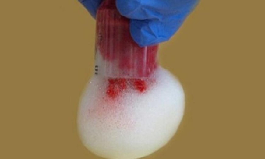 ابتكار رغوة ذكية لإيقاف النزيف الداخلي وإنقاذ الأرواح من خطر الموت