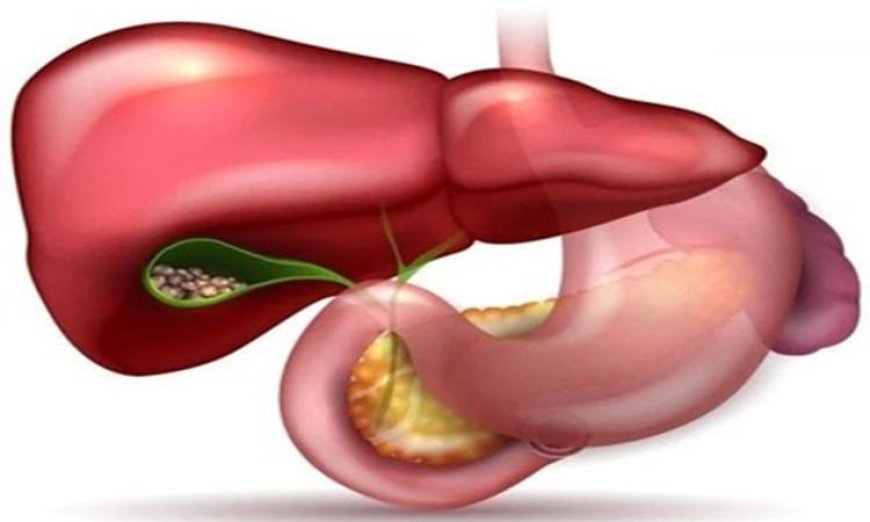 نساء أكثر عرضة للإصابة بحصوات المرارة تعرف على الأسباب والعوامل المؤثرة