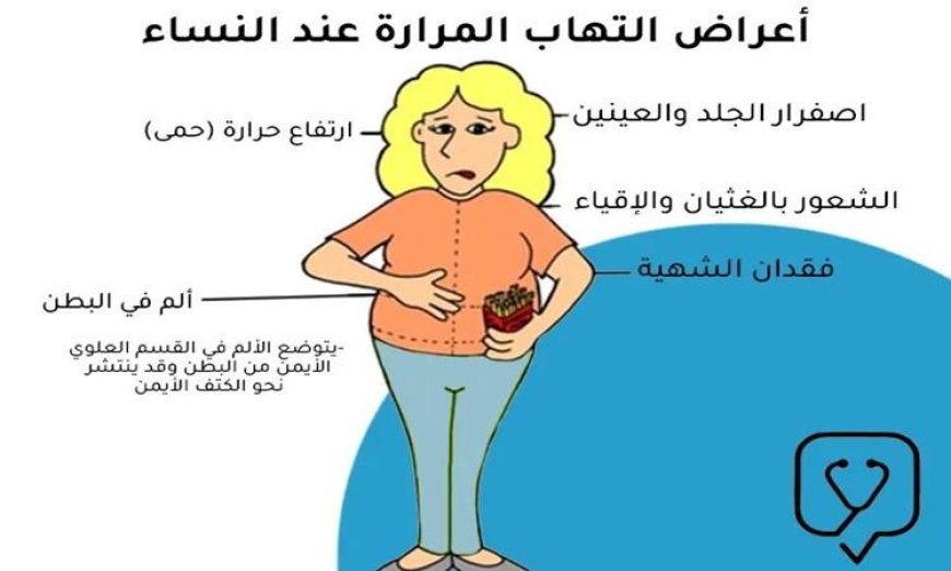 كل ما تحتاج معرفته عن أعراض حصوات المرارة عند النساء ووسائل العلاج الفعالة