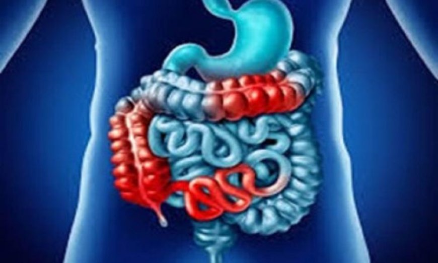 اكتشاف جديد يحقق الأمل لمرضى تليف الأمعاء وينهي معاناتهم