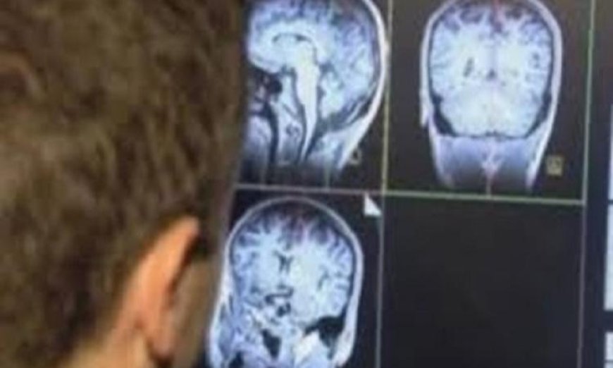 الرياضة تعالج آثار الصدمات النفسية في الدماغ الناتجة عن تجارب الطفولة