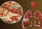 اكتشاف الإنزيم القاتل لبكتيريا السل يعزز الأمل في علاج فعال