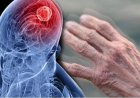 دراسة جامعة ييل تكشف أسرار جديدة حول مرض باركنسون