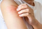 اكتشاف علماء “زر خفي” في الدماغ يتحكم في شعور الحكة ويحدد متى يجب التوقف عن الحك