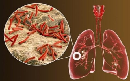 اكتشاف الإنزيم القاتل لبكتيريا السل يعزز الأمل في علاج فعال