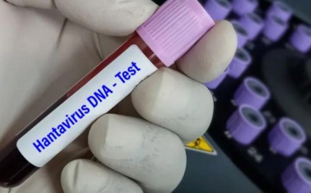 لندن تتخذ خطوات وقائية لاستقبال مواطنين بريطانيين مصابين بفيروس هانتا