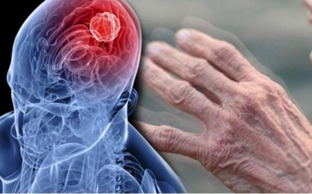 دراسة جامعة ييل تكشف أسرار جديدة حول مرض باركنسون