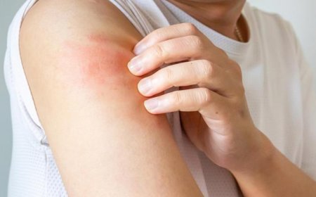 اكتشاف علماء “زر خفي” في الدماغ يتحكم في شعور الحكة ويحدد متى يجب التوقف عن الحك