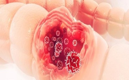 جين جديد يعزز صحة الأمعاء ويحمي من الأمراض