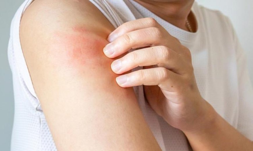 اكتشاف علماء “زر خفي” في الدماغ يتحكم في شعور الحكة ويحدد متى يجب التوقف عن الحك