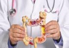 علماء يكشفون عن مزيج غذائي فعال للوقاية من سرطان القولون