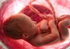 تحسين التغذية يعزز صحة المواليد الجدد ويوفر لهم بداية صحية