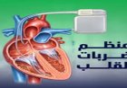 تقنية ثورية لتنظيم نبضات القلب بدون الحاجة للجراحة