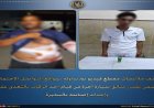 عامل يعتدي على سائق سيارة أجرة في البحيرة ويسبب له إصابات خطيرة
