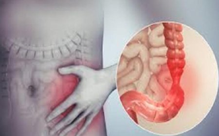 نموذج مخبري مبتكر يحاكي الأمعاء يكشف النقاب عن الأمراض المتعلقة بها