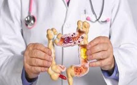 علماء يكشفون عن مزيج غذائي فعال للوقاية من سرطان القولون