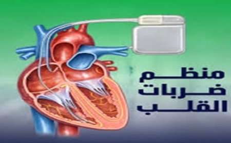 تقنية ثورية لتنظيم نبضات القلب بدون الحاجة للجراحة