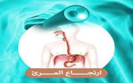 جل ثوري يلصق بالمريء لعلاج الالتهابات المستعصية بفعالية