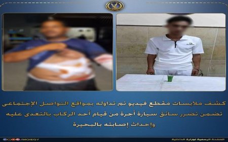 عامل يعتدي على سائق سيارة أجرة في البحيرة ويسبب له إصابات خطيرة