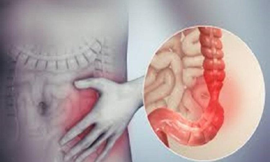 نموذج مخبري مبتكر يحاكي الأمعاء يكشف النقاب عن الأمراض المتعلقة بها