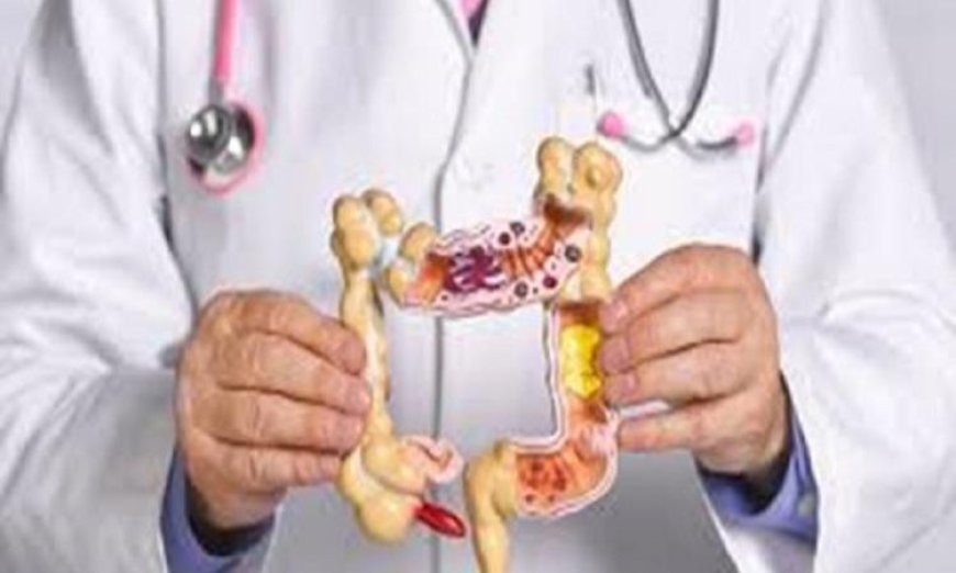علماء يكشفون عن مزيج غذائي فعال للوقاية من سرطان القولون