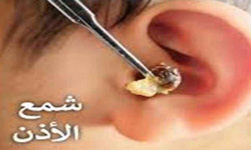 اكتشف الحقائق المثيرة عن شمع الأذن والمخاطر المرتبطة بإزالته