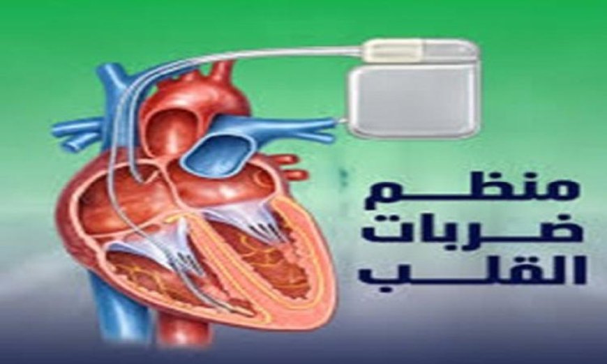 تقنية ثورية لتنظيم نبضات القلب بدون الحاجة للجراحة