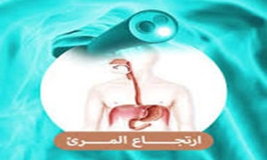 جل ثوري يلصق بالمريء لعلاج الالتهابات المستعصية بفعالية