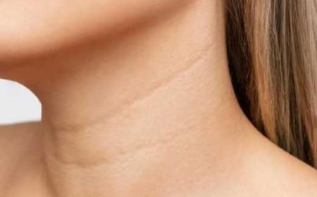 طرق فعالة وطبيعية للقضاء على تجاعيد الرقبة بسهولة
