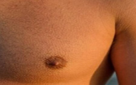 اكتشاف السرطان في مراحله المتأخرة عند الرجال وأسبابه وتأثيراته