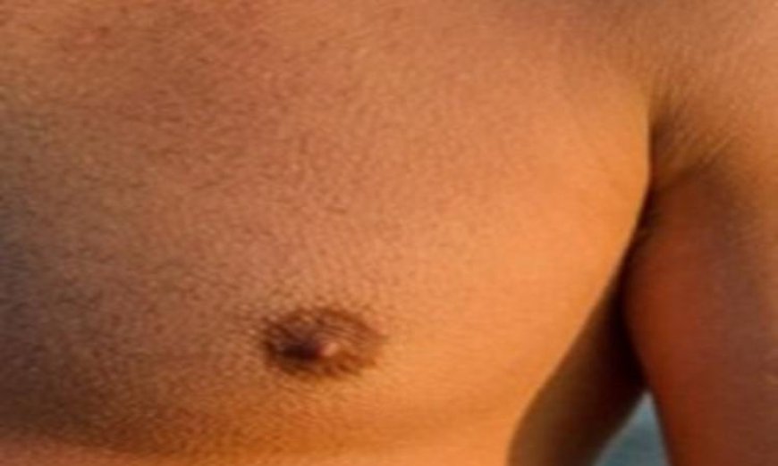 اكتشاف السرطان في مراحله المتأخرة عند الرجال وأسبابه وتأثيراته