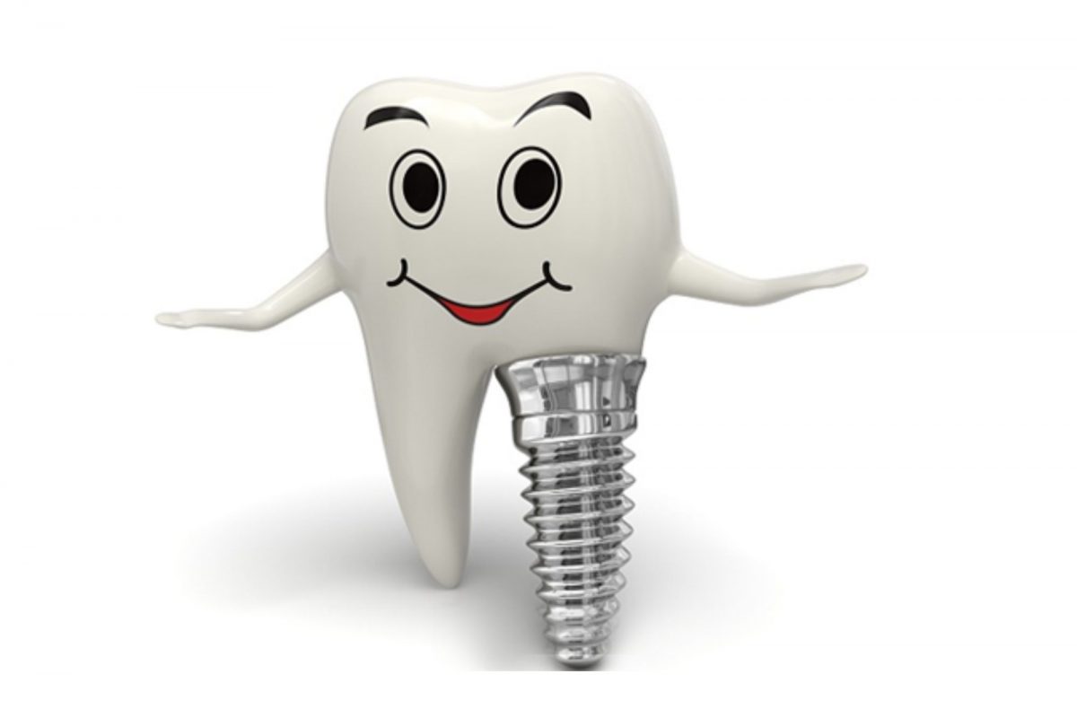 كيف تختار بين زراعة الأسنان الفورية وزراعة الأسنان التقليدية؟