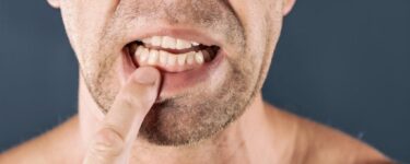 تفسير حلم الأسنان الأمامية تهتز في المنام