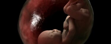 تفسير حلم اجهاض الجنين لغير الحامل